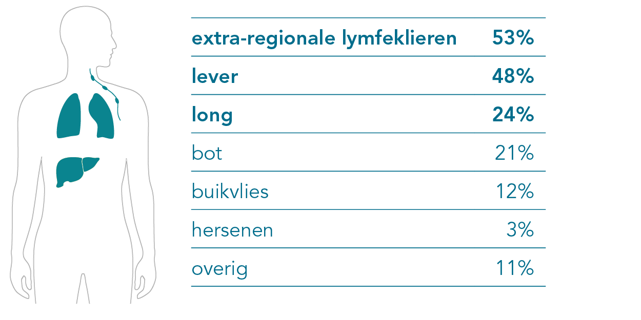 locaties van metastase