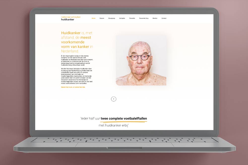 mock-up van homepage website Nationaal Actieplan Huidkanker