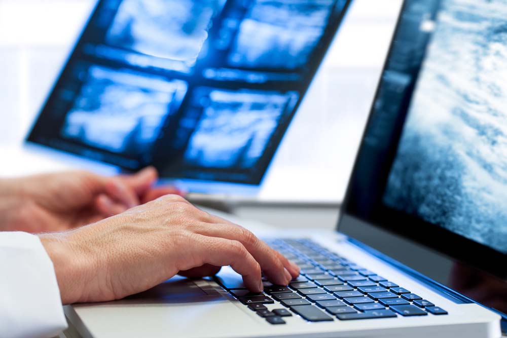 arts met alleen handen in beeld bekijkt röntgenfoto op laptop