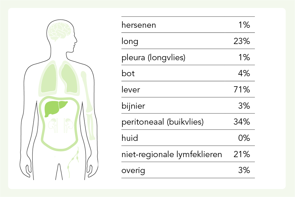 Uitzaaiingen bij darmkanker