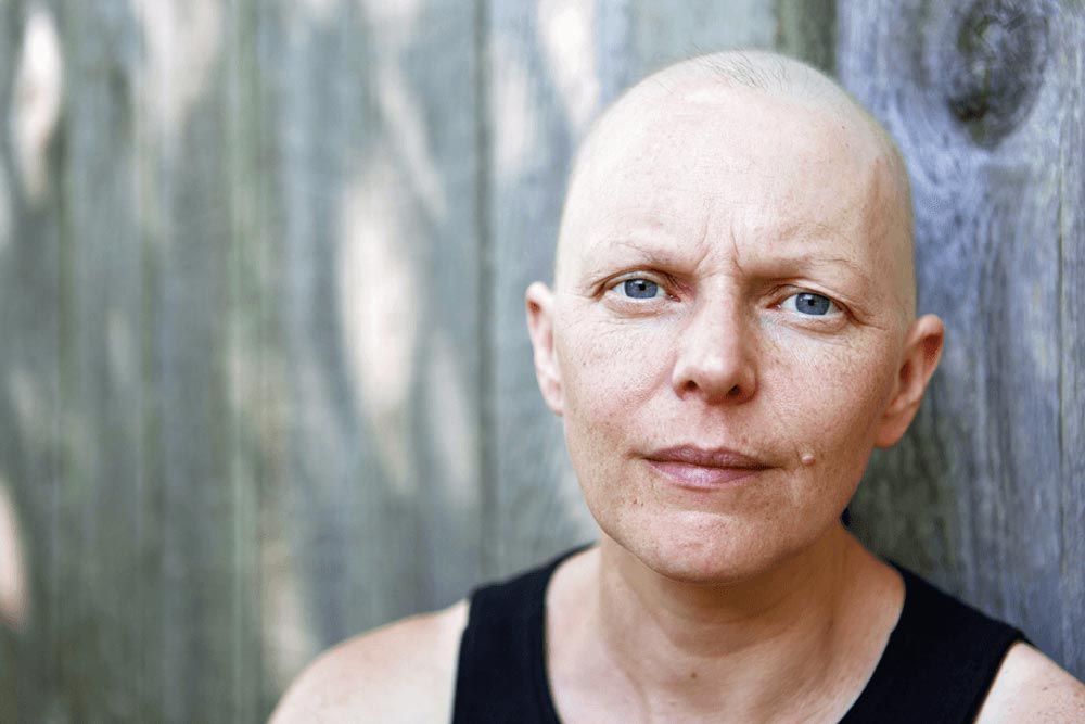 Hoofdhuidkoeling: verdraagbare optie tegen haarverlies door chemotherapie